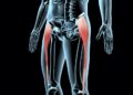 3 Major Hip Flexor Muscles Iliacus, TFL, and Psoas
