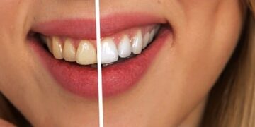 Can Your Teeth Impact Your Career as a Business Leader?